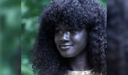Melanin