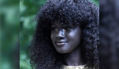 Melanin