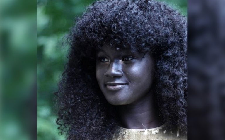 Melanin