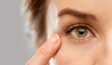 Skin Around the Eyes