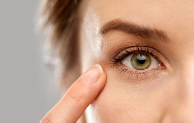 Skin Around the Eyes