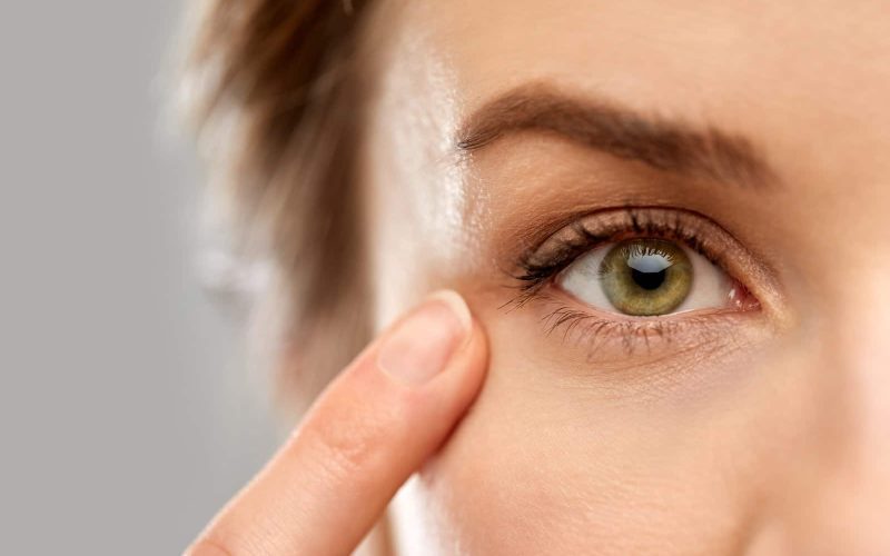 Skin Around the Eyes