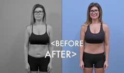 Mommy Makeover