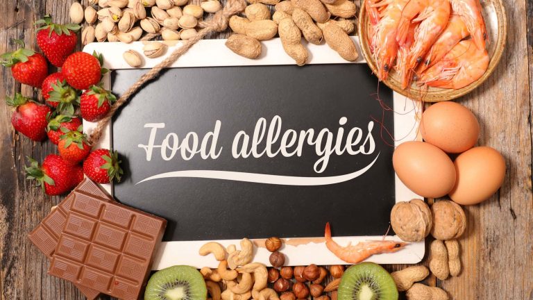 Food Allergy