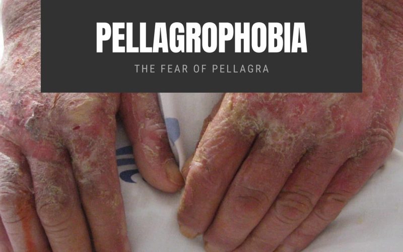 Pellagrophobia The Fear of Pellagra