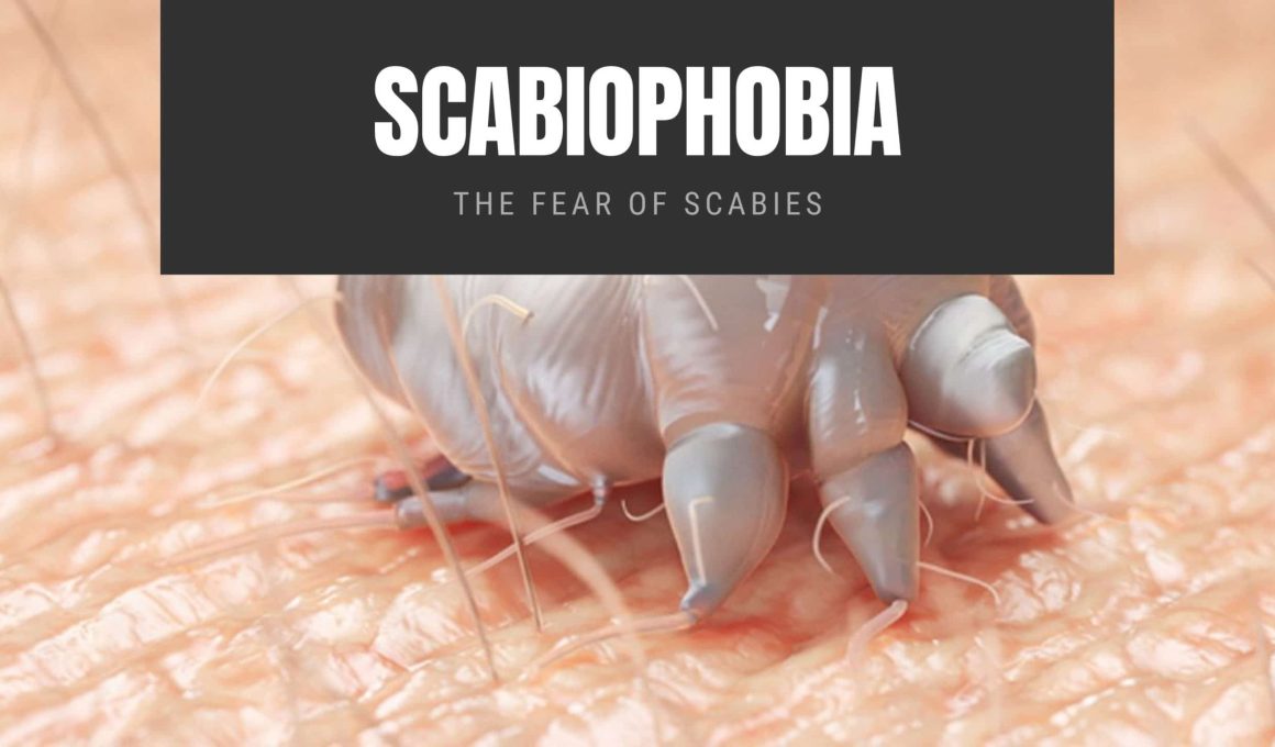 Scabiophobia The Fear of Scabies