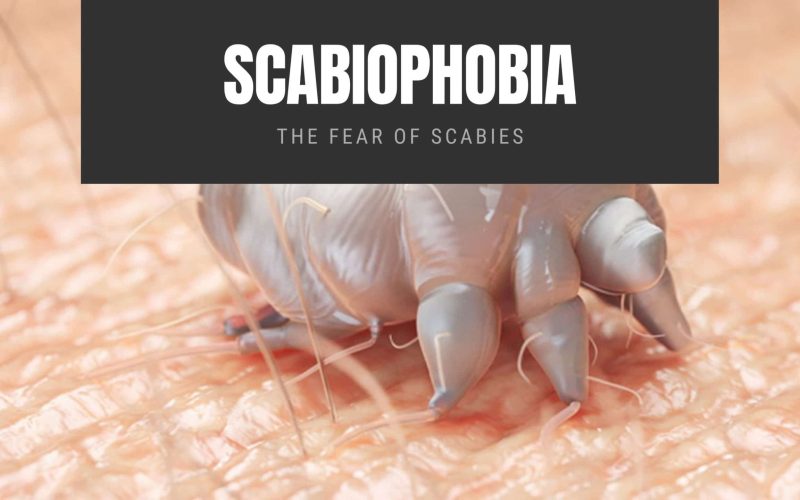 Scabiophobia The Fear of Scabies