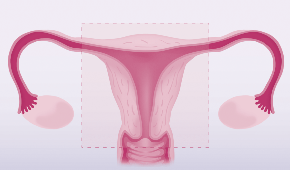 Pros and Cons of a Hysterectomy