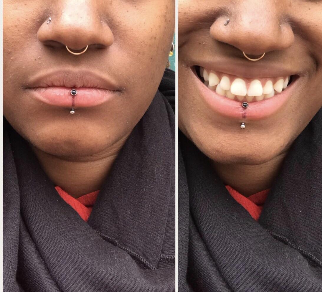 Labret Lip Piercing